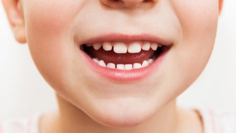 مراحل تشکیل،رشد،تکامل،مراقبت و تعداد دندان های انسان